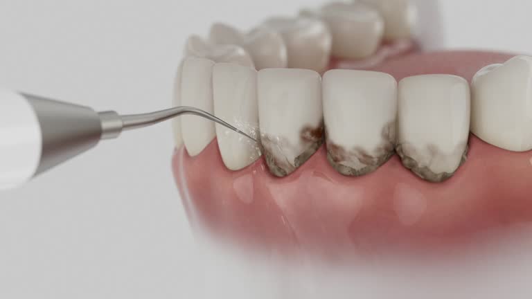 Trusted Teeth Cleaning And Checkup service in Eucalyptus Hills, CA - Dentist Open Now